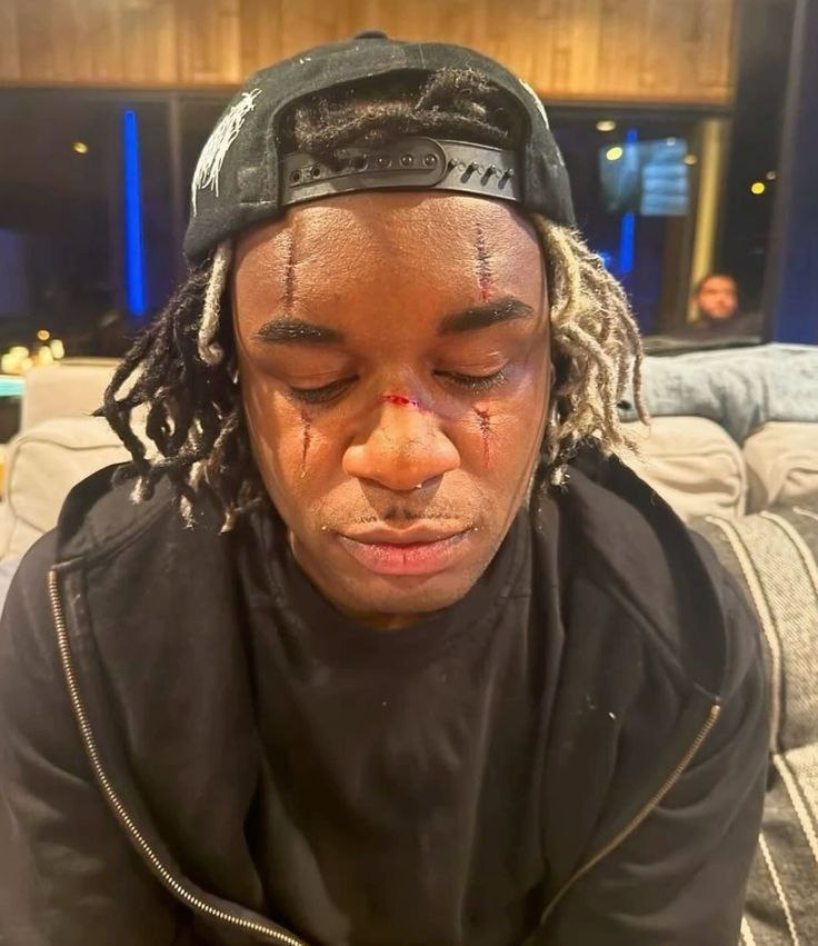 KEN CARSON TYPE BEAT - "STARSHIP" | RAGE OPIUM